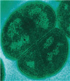 Imagen de Deinococcus radiodurans