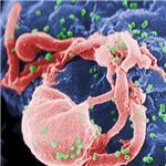 Imagen coloreada del VIH-1 (en verde) ensamblándose en un linfocito